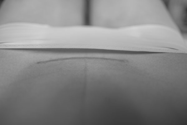 Caesarean Scar Massage